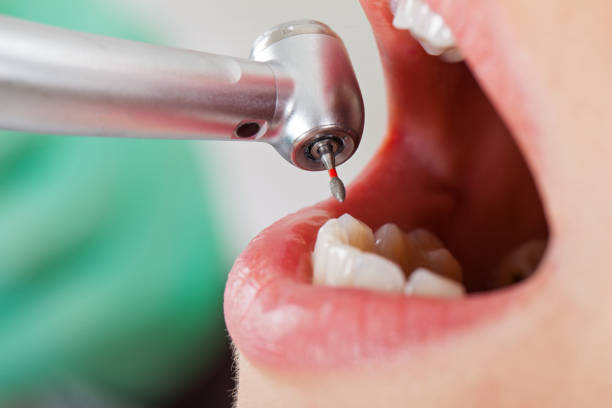 Best Emergency Dentist for Knocked-Out Tooth in Franklin, TX